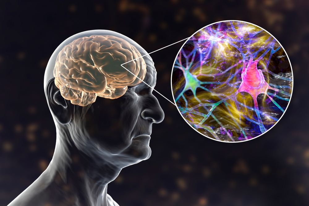 심리장애 임상사례